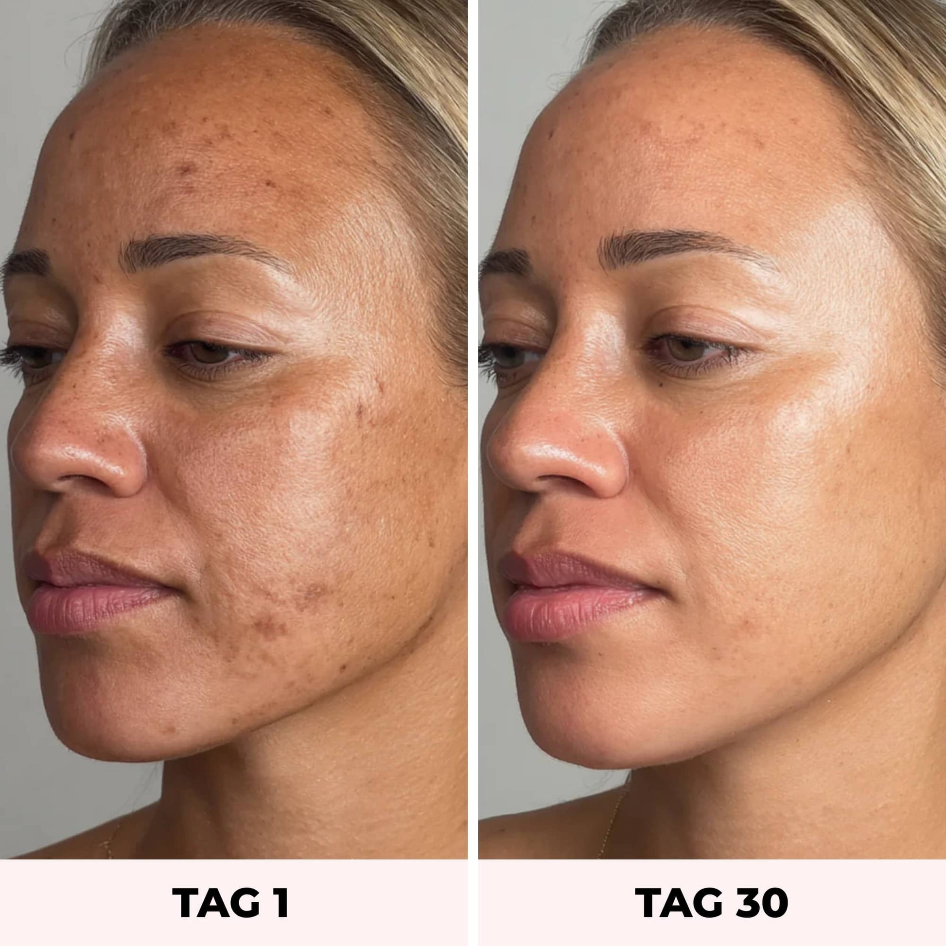 LYVEA Face Sculptor