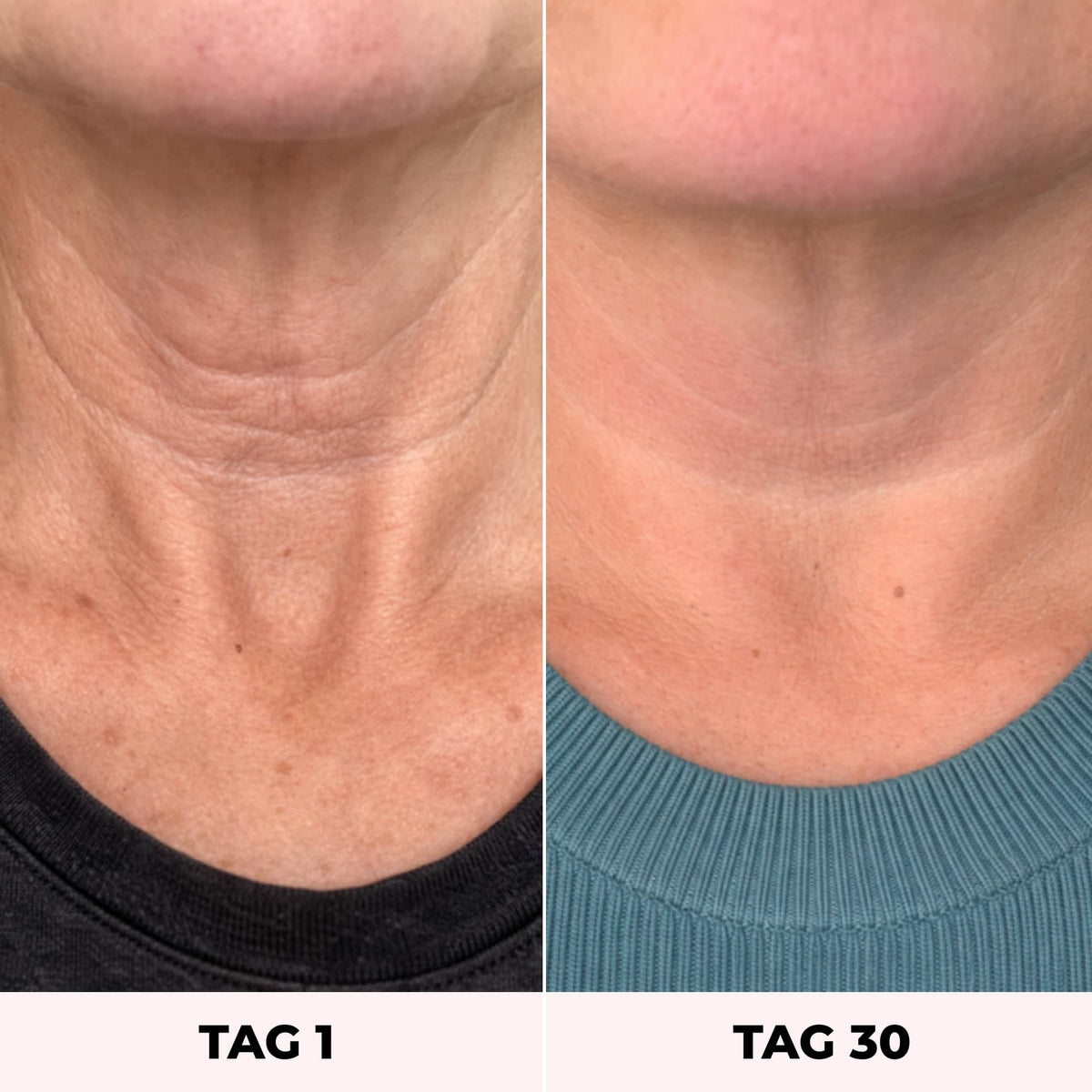 LYVEA 7-in-1 Facial Sculptor
