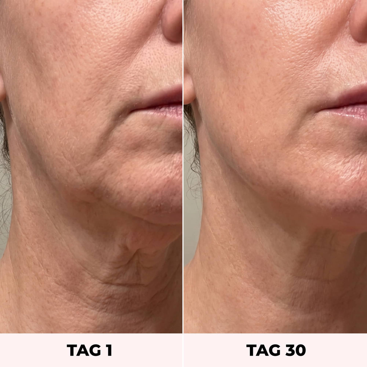 LYVEA 7-in-1 Facial Sculptor