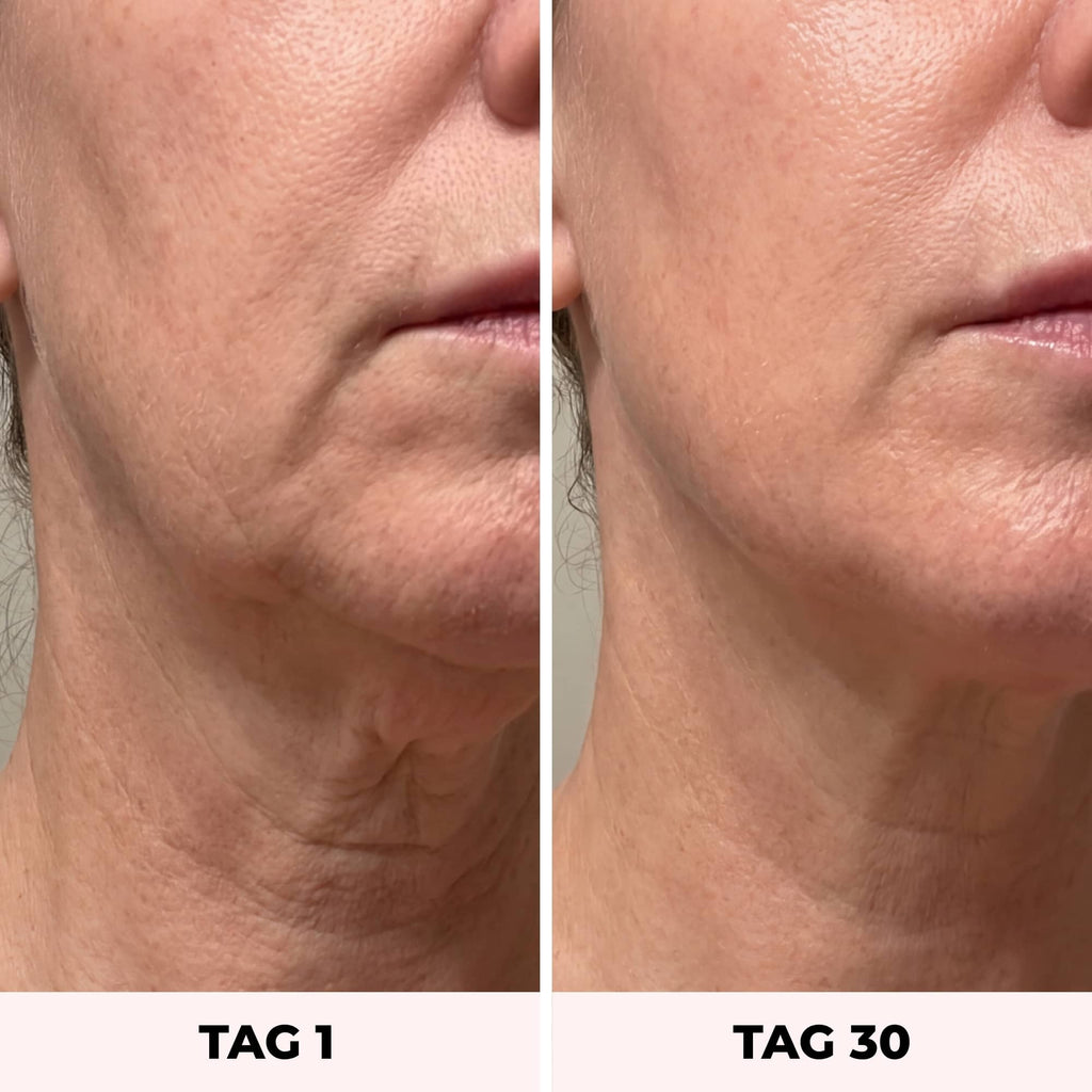 LYVEA Face Sculptor